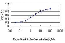 Anti-RALGPS2 Mouse Monoclonal Antibody [clone: 3F1]