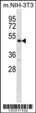 Anti-RPS6KB2 Rabbit Polyclonal Antibody (AP (Alkaline Phosphatase))