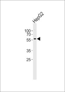 Anti-GABRA3 Rabbit Polyclonal Antibody