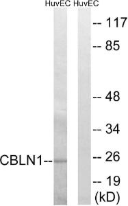 Western blot analysis of lysates from HUVEC cells using Anti-CBLN1 Antibody. The right hand lane represents a negative control, where the antibody is blocked by the immunising peptide