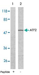 Anti-ATF2 Rabbit Polyclonal Antibody