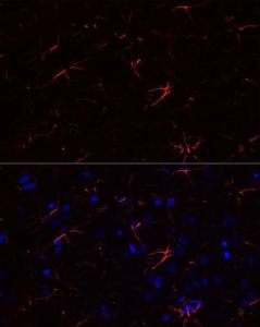 Anti-GFAP Rabbit Monoclonal Antibody [clone: ARC0206]