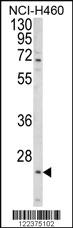 Anti-ALG14 Rabbit Polyclonal Antibody