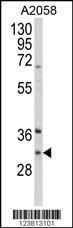 Anti-ING5 Rabbit Polyclonal Antibody (AP (Alkaline Phosphatase))