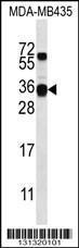 Anti-CSN2 Rabbit Polyclonal Antibody (Biotin)