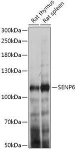 Western blot analysis of extracts of various cell lines, using Anti-SENP6 Antibody (A307283) at 1:1,000 dilution. The secondary antibody was Goat Anti-Rabbit IgG H&L Antibody (HRP) at 1:10,000 dilution.