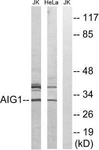 Western blot analysis of lysates from HeLa and Jurkat cells using Anti-AIG1 Antibody. The right hand lane represents a negative control, where the antibody is blocked by the immunising peptide