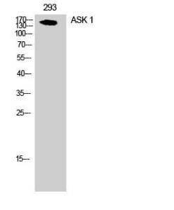 Antibody anti-ASK1 100 µg