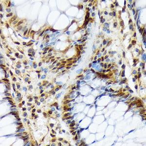 Immunohistochemistry analysis of paraffin-embedded human colon tissue using Anti-COPS3/CSN3 Antibody [ARC2182] (A308299) at a dilution of 1:100 (40x lens) Perform microwave antigen retrieval with 10 mM Tris/EDTA buffer pH 90 before commencing with IHC staining protocol