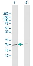 Anti-ESM1 Rabbit Polyclonal Antibody