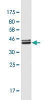 Anti-PFDN4 Mouse Monoclonal Antibody [clone: 2G4]