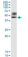 Anti-MICB Polyclonal Antibody Pair