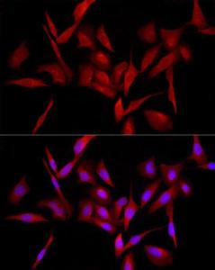 Immunofluorescence analysis of U2OS cells using Anti-MyD88 Antibody (A12738) at a dilution of 1:100 (40X lens). DAPI was used to stain the cell nuclei (blue)