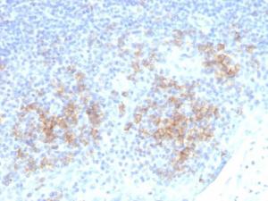 Immunohistochemical analysis of formalin-fixed, paraffin-embedded human tonsil using Anti-CD38 Antibody [CD38/4328]