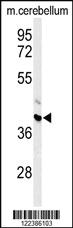 Anti-MFSD2B Rabbit Polyclonal Antibody