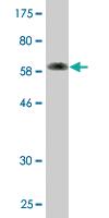 Anti-ATP6V0D1 Mouse Monoclonal Antibody [clone: 3B7]