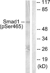 Western blot analysis of lysates from HeLa cells treated with Serum 10% 15' using Anti-Smad1 (phospho Ser465) Antibody. The right hand lane represents a negative control, where the antibody is blocked by the immunising peptide.