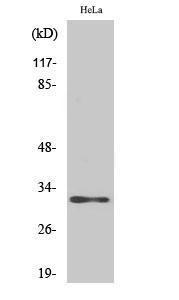 Western blot analysis of various cells using Anti-AIG1 Antibody