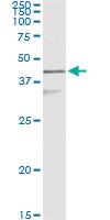 Anti-CK17 Mouse Monoclonal Antibody [clone: 2D4-1G9]