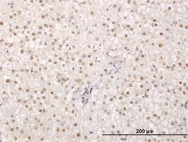 Anti-TPRX1 Mouse Monoclonal Antibody [clone: 2B4]