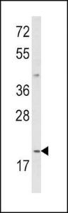 Anti-IL12A Rabbit Polyclonal Antibody (Biotin)