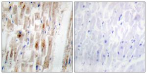 Immunohistochemical analysis of paraffin-embedded human heart using Anti-Smad1 (phospho Ser465) Antibody. The right hand panel represents a negative control, where the antibody was pre-incubated with the immunising peptide.