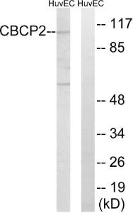 Anti-CBCP2 Rabbit Polyclonal Antibody