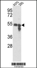 Anti-RIPK2 Rabbit Polyclonal Antibody