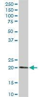 Anti-ESM1 Rabbit Polyclonal Antibody