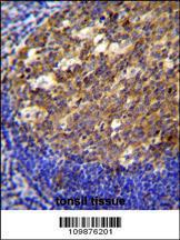 Anti-TWF2 Rabbit Polyclonal Antibody (PE (Phycoerythrin))