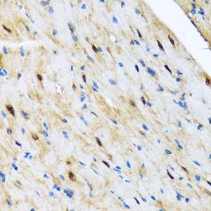 Immunohistochemistry analysis of paraffin-embedded mouse heart using Anti-COPS3/CSN3 Antibody [ARC2182] (A308299) at a dilution of 1:100 (40x lens) Perform microwave antigen retrieval with 10 mM Tris/EDTA buffer pH 90 before commencing with IHC staining protocol