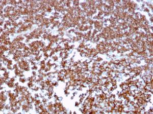 Anti-CD20 Mouse Monoclonal Antibody [clone: MS4A1/3409]