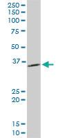 Anti-PPA1 Mouse Monoclonal Antibody [clone: 3B2]