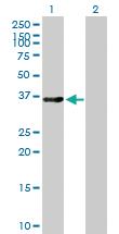 Anti-LMOD1 Mouse Polyclonal Antibody