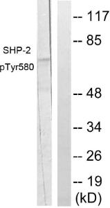 Western blot analysis of lysates from A431 cells using Anti-SHP-2 (phospho Tyr580) Antibody. The right hand lane represents a negative control, where the antibody is blocked by the immunising peptide.