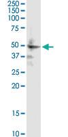 Anti-ZIC1 Mouse Monoclonal Antibody [clone: 4D2]