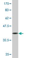 Anti-EPB42 Mouse Monoclonal Antibody [clone: 2G12]