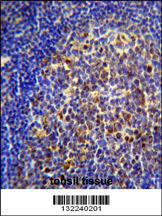 Anti-CHRNA10 Rabbit Polyclonal Antibody (HRP (Horseradish Peroxidase))