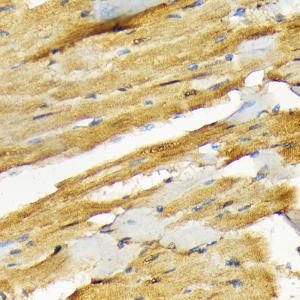 Immunohistochemistry analysis of paraffin-embedded rat heart using Anti-COPS3/CSN3 Antibody [ARC2182] (A308299) at a dilution of 1:100 (40x lens) Perform microwave antigen retrieval with 10 mM Tris/EDTA buffer pH 90 before commencing with IHC staining protocol