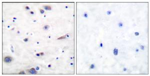 Immunohistochemical analysis of paraffin-embedded human brain using Anti-SHP-2 (phospho Tyr580) Antibody. The right hand panel represents a negative control, where the antibody was pre-incubated with the immunising peptide.