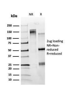 SDS-PAGE analysis of Anti-ZBTB7C Antibody [PCRP-ZBTB7C-4E12] under non-reduced and reduced conditions; showing intact IgG and intact heavy and light chains, respectively. SDS-PAGE analysis confirms the integrity and purity of the antibody