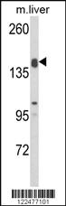 Anti-ADAMTS18 Rabbit Polyclonal Antibody