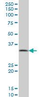 Anti-PPA1 Mouse Monoclonal Antibody [clone: 3B2]