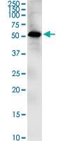 Anti-ZIC1 Mouse Monoclonal Antibody [clone: 1A8]