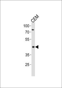 Anti-FADS2 Rabbit Polyclonal Antibody (HRP (Horseradish Peroxidase))