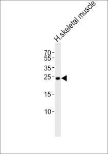 Anti-TMEM239 Rabbit Polyclonal Antibody