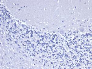 Negative Tissue Control: Immunohistochemical analysis of formalin-fixed, paraffin-embedded human brain using Anti-Cytokeratin 8 Antibody [rKRT8/6471] at 2 µg/ml in PBS for 30 minutes at room temperature