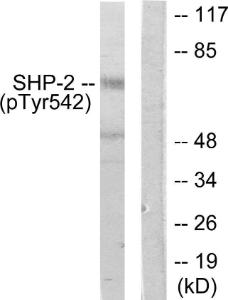 Western blot analysis of lysates from A431 cells using Anti-SHP-2 (phospho Tyr542) Antibody. The right hand lane represents a negative control, where the Antibody is blocked by the immunising peptide