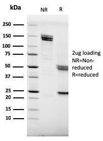 Anti-CD20 Mouse Monoclonal Antibody [clone: MS4A1/3409]