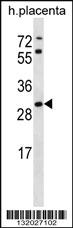 Anti-STARD4 Rabbit Polyclonal Antibody